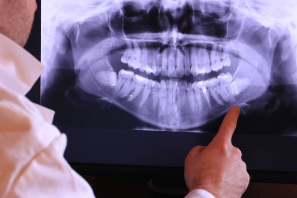 Best Weekend Emergency Dentist in Vinings, GA