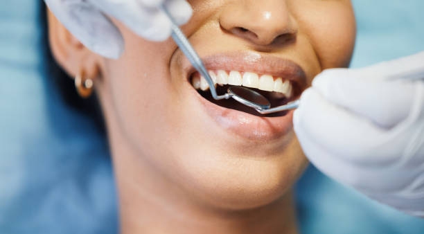 Best Emergency Treatment for Dental Infections or Abscesses in Vinings, GA